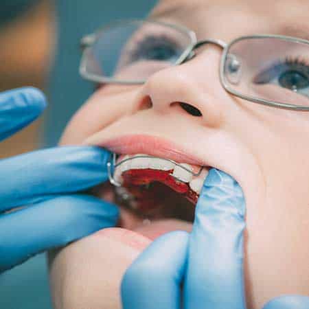 Orthodontic Appliance for Dental Correction