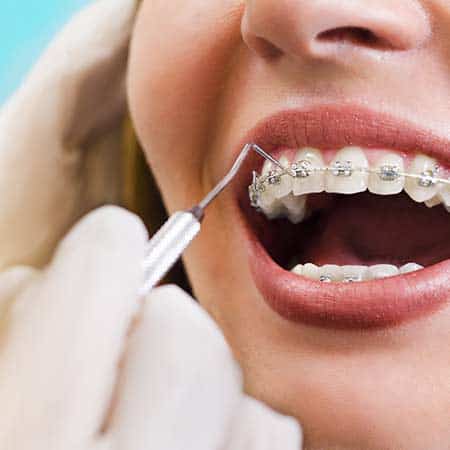 Orthodontics at Stoney Trail Dental